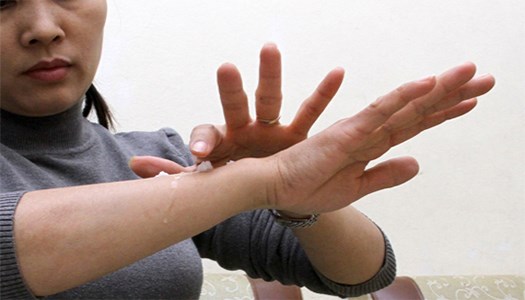 Chọn thuốc trị da khô nẻ