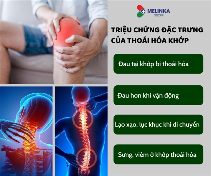 Nỗi lo căn bệnh thoái hóa khớp ở người cao tuổi
