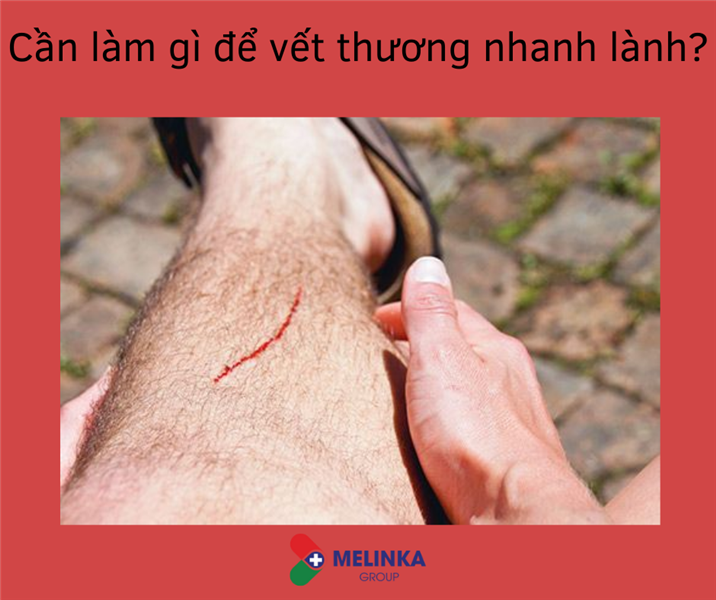Quy trình chăm sóc vết thương đúng cách tại nhà
