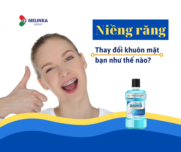[Giải đáp] Niềng răng có làm thay đổi khuôn mặt không?