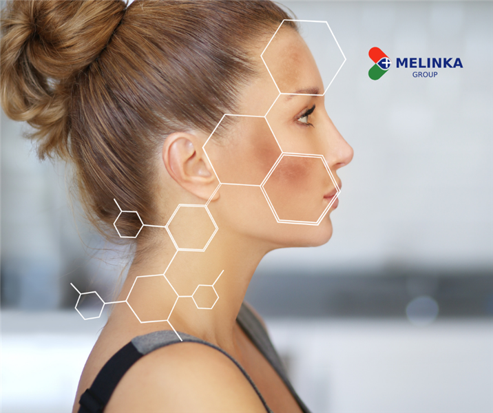 Xóa bỏ nỗi ám ảnh nám, sạm da của phụ nữ tuổi trung niên