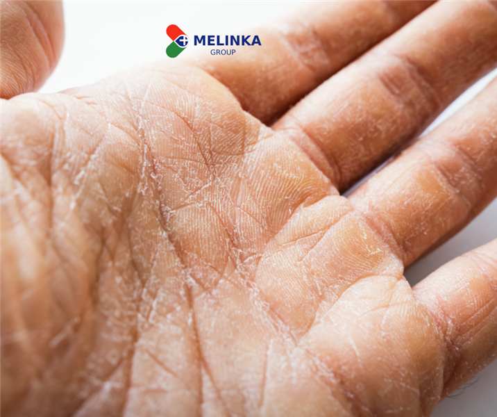  Bảo vệ đôi tay của bạn khỏi bị 'già hóa” vì dịch COVID-19