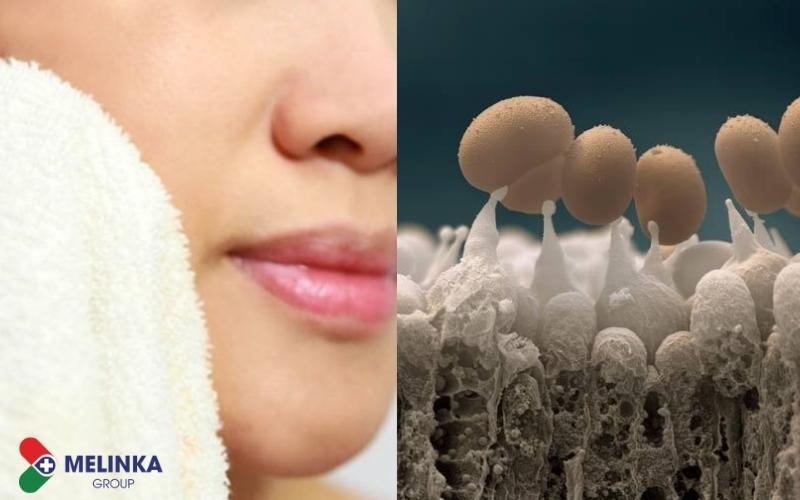 Bạn có đang rửa mặt sai cách?