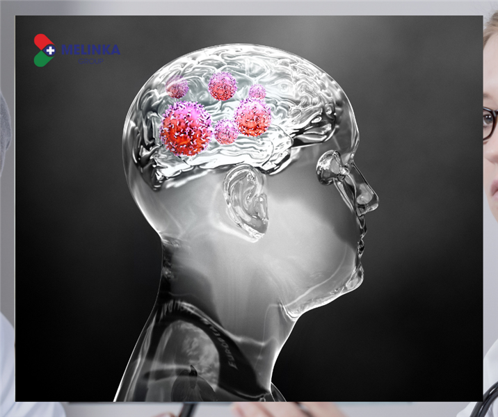 Cảnh báo 09 dấu hiệu u não ở trẻ em cần chú ý