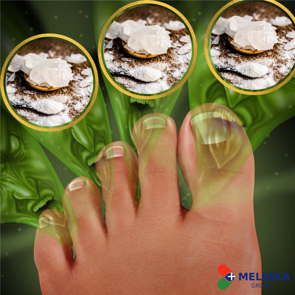 GIẢM MÙI HÔI CHÂN BẰNG CÁCH NÀO? 