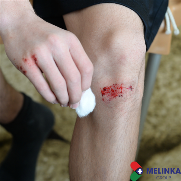 4 GIAI ĐOẠN CỦA QUÁ TRÌNH LÀM LÀNH VẾT THƯƠNG