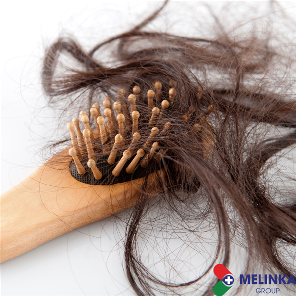 CÁCH CHỮA RỤNG TÓC TẠI NHÀ ĐƠN GIẢN VÀ HIỆU QUẢ BẠN NÊN BIẾT 