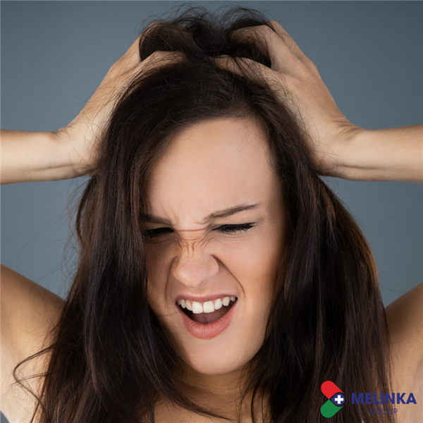 5 CÁCH TRỊ GÀU BẰNG NGUYÊN LIỆU CÓ SẴN TẠI NHÀ