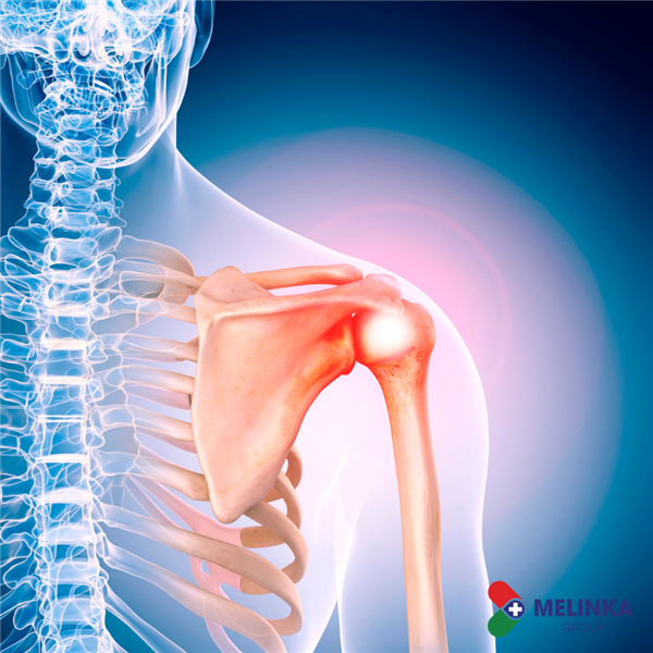 MỘT SỐ BÀI THUỐC DÂN GIAN CHỮA ĐAU VAI GÁY HIỆU QUẢ